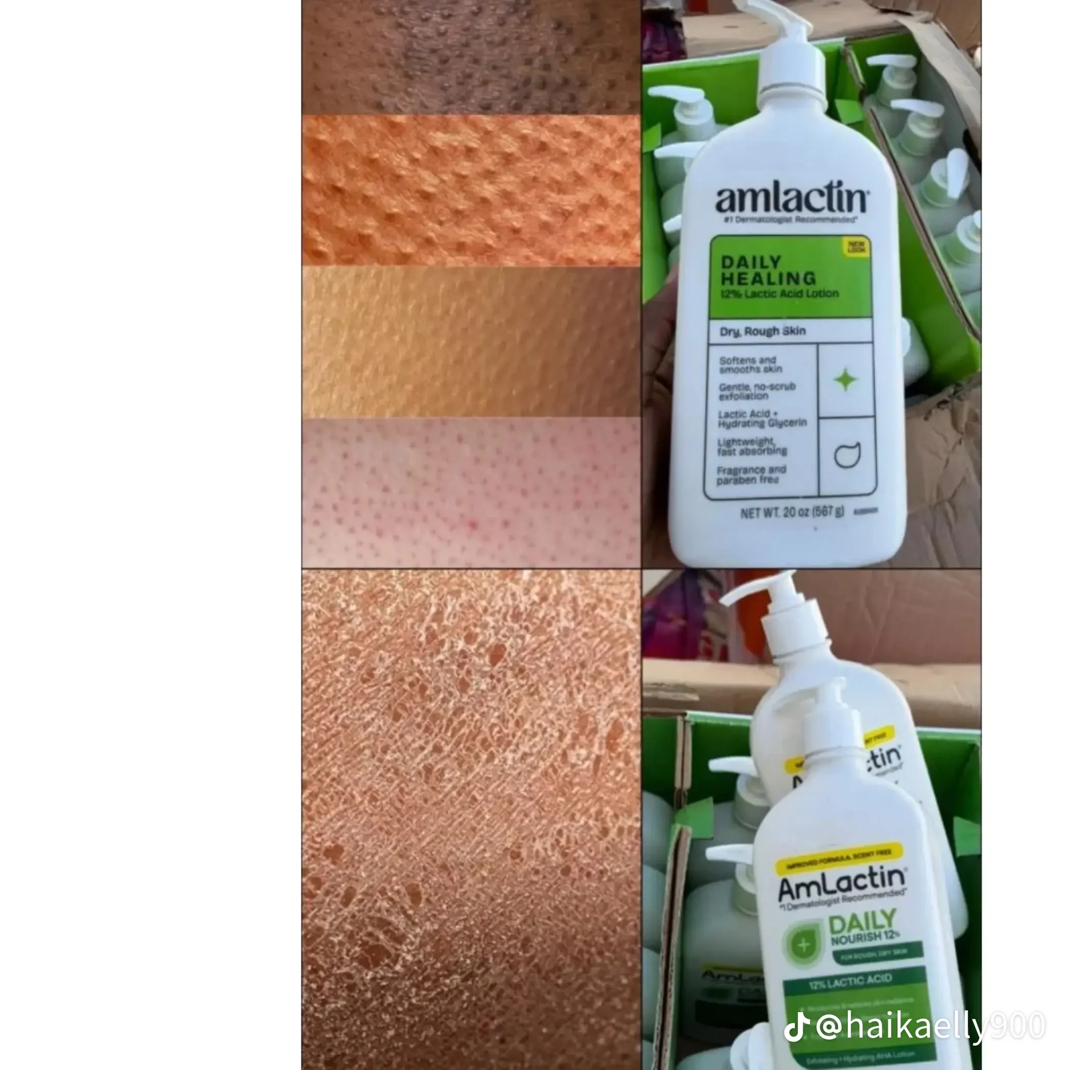 Amlactin